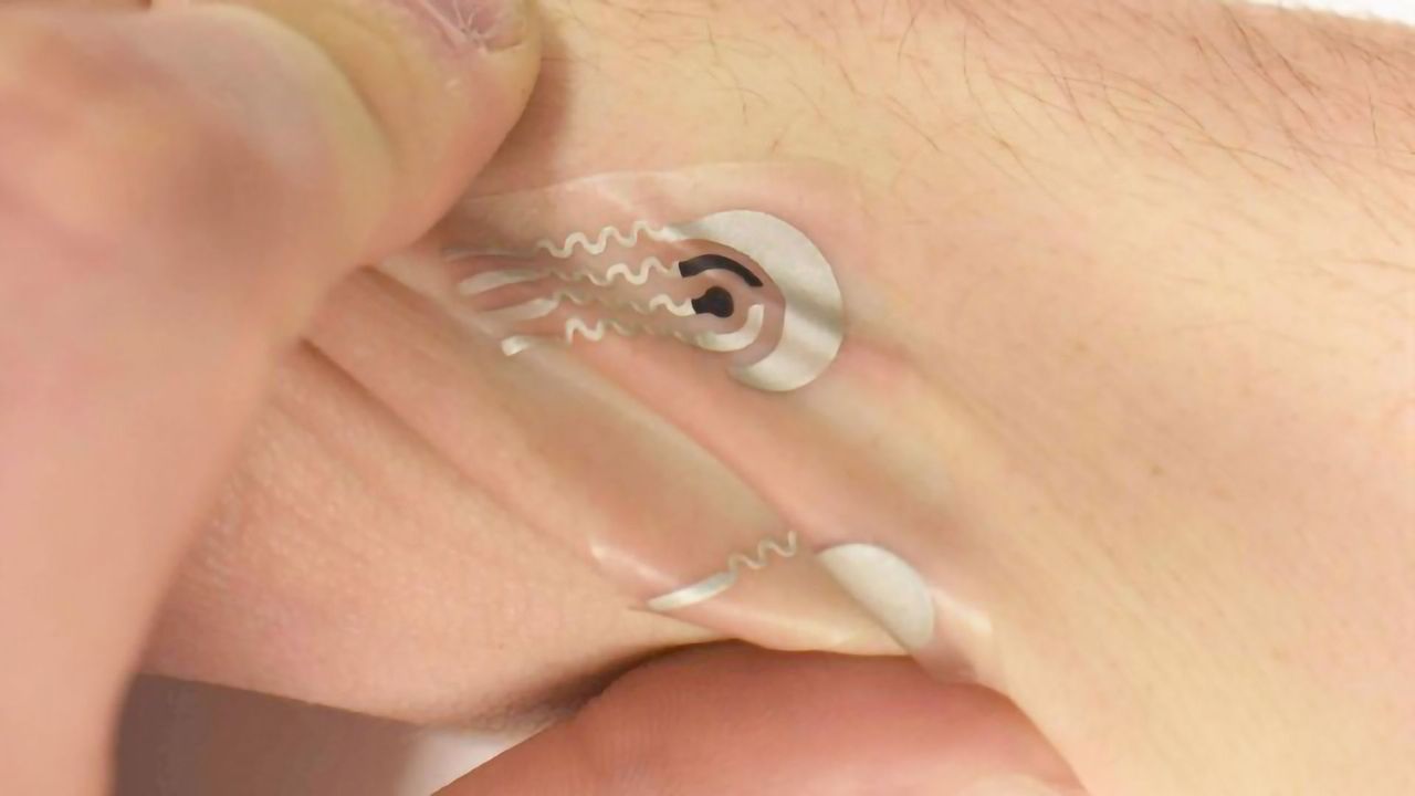 Dietary Tracking You Can't Cheat - A Wearable Vitamin C Sensor