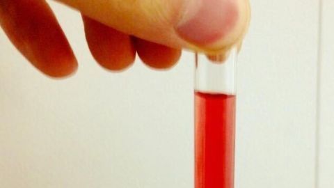 Ancient Proteins Reveal Simple Beginnings of Complex Hemoglobin
