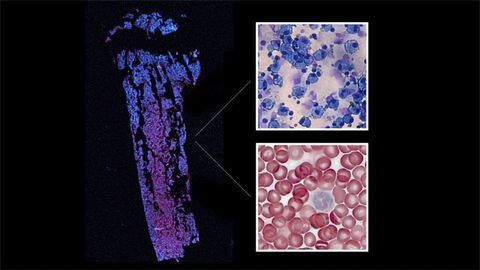 Epigenetic Mechanisms of Blood Cell Differentiation