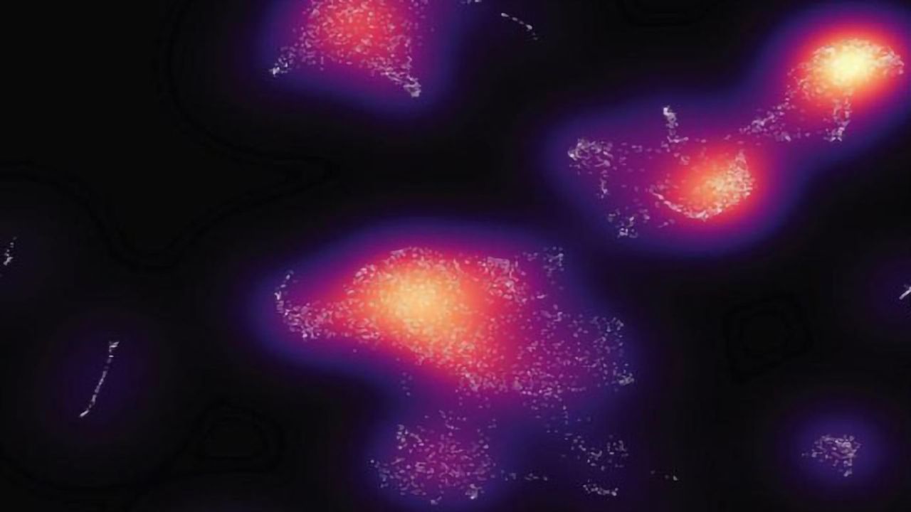 Inherited Genetics Can Drive Spread of Skin Cancer