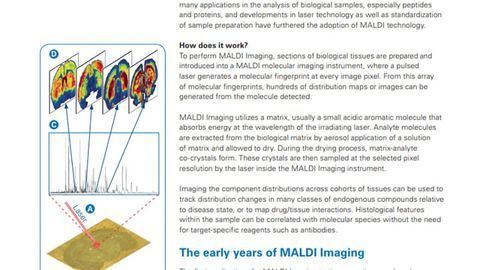 MALDI成像：过去，现在和未来