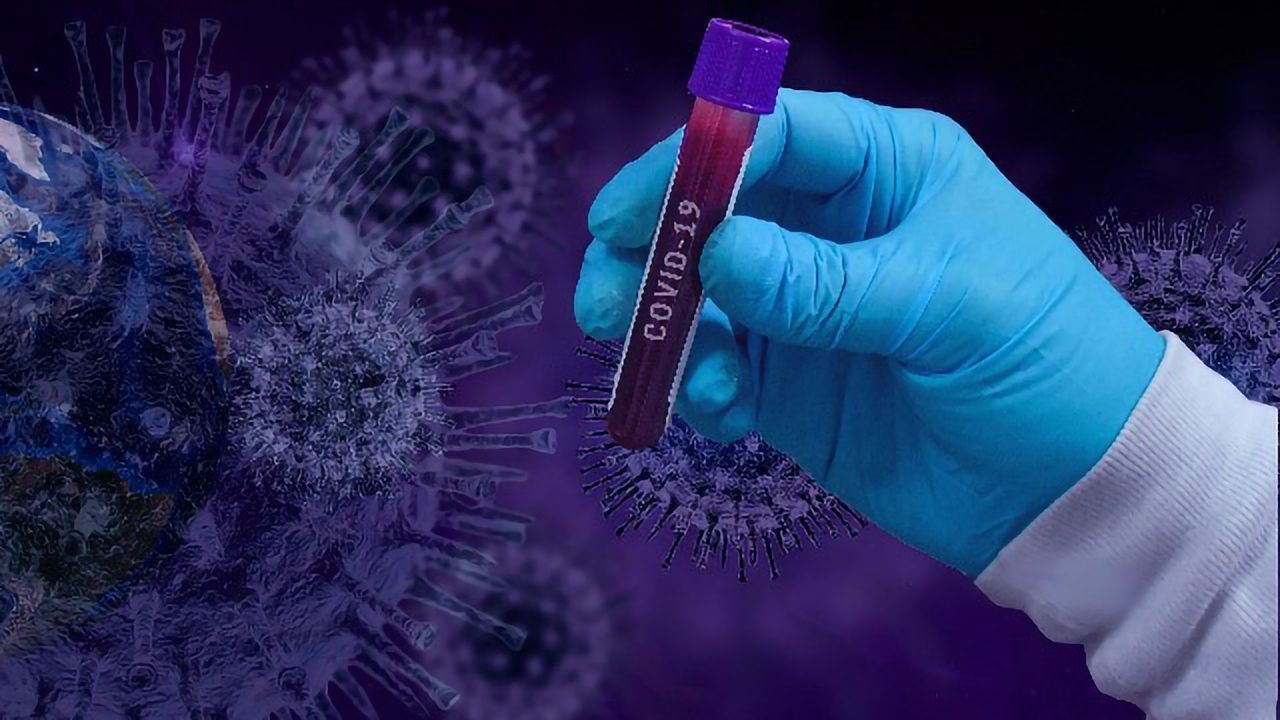 Blood Test Could Track Immune Response to COVID-19