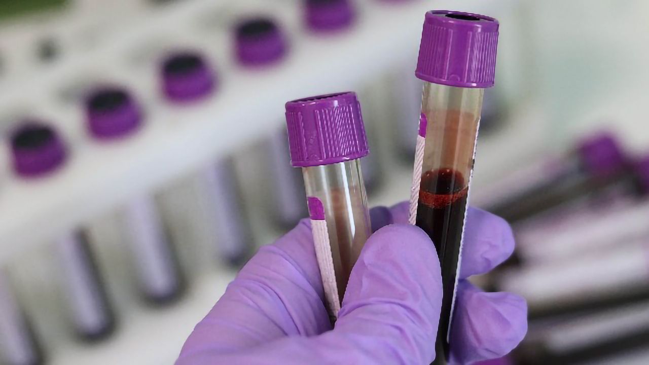 New Lung Cancer Trial Will Use Personalized Monitoring To Help Predict Relapse