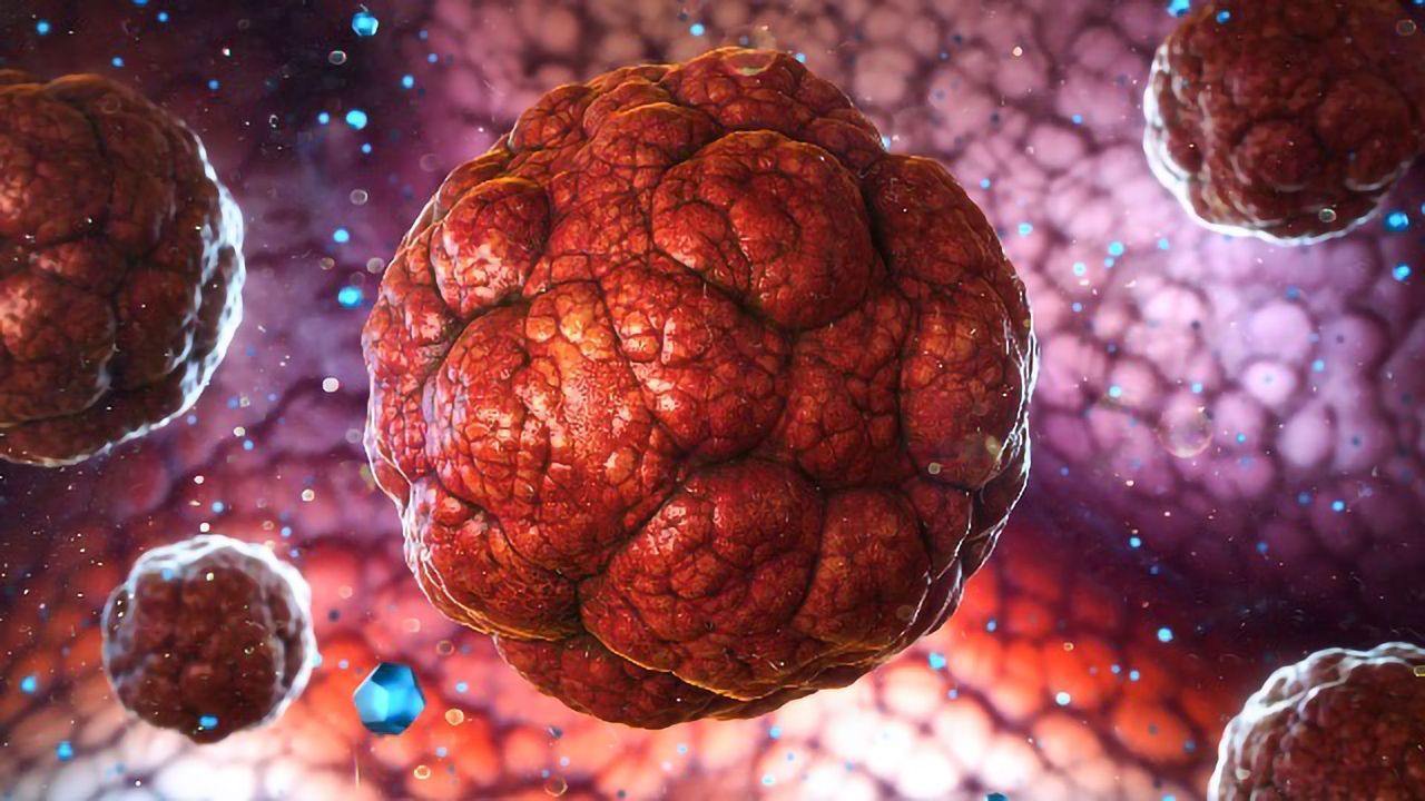 Anti-malarial Drug Shows Potential as Brain Cancer Treatment in Preclinical Models