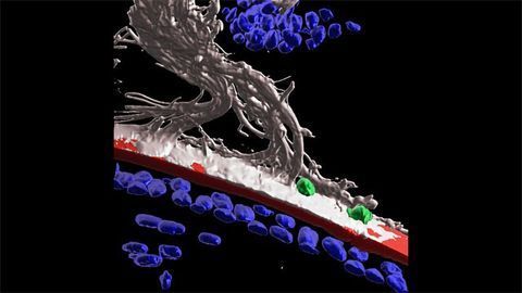 Immune Protection of Lens in Eye Injury Challenges Idea of Immune Isolation