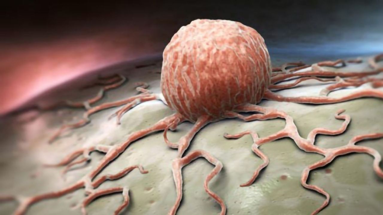 A High-resolution 3D View Inside Tumors