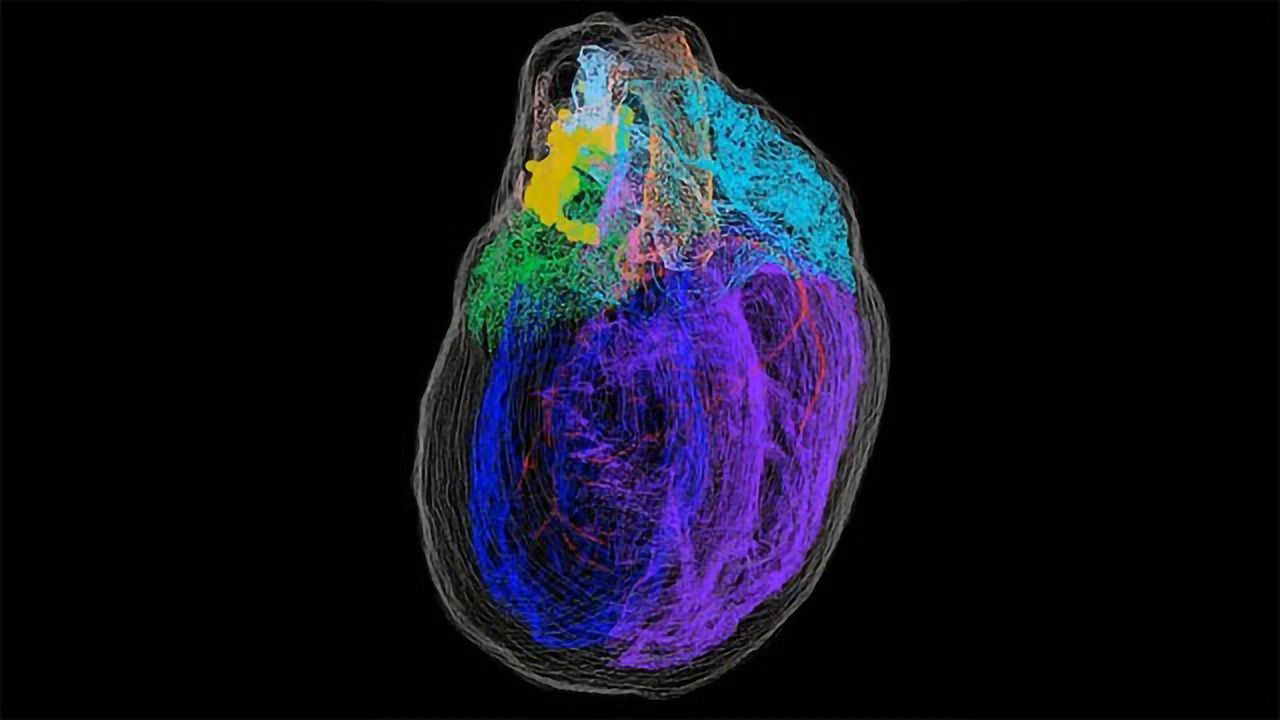 Mapping the Neurons of the Rat Heart in 3D