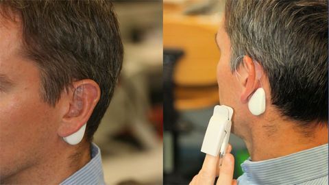 Could Electrical Impulses Relieve Chronic Pain by Stimulating the Vagus Nerve?