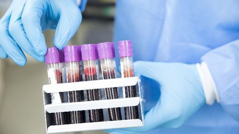 New Testing System Predicts Septic Shock Outcomes