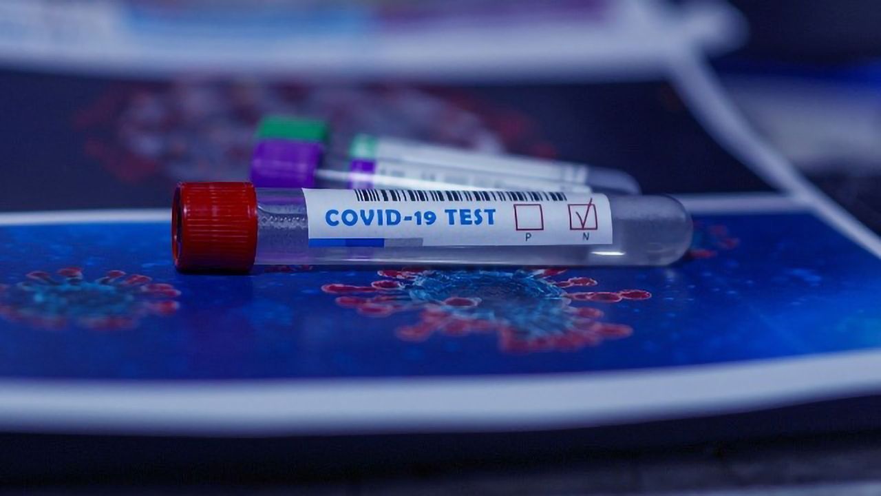 Beware of False Negatives in Diagnostic Testing of COVID-19