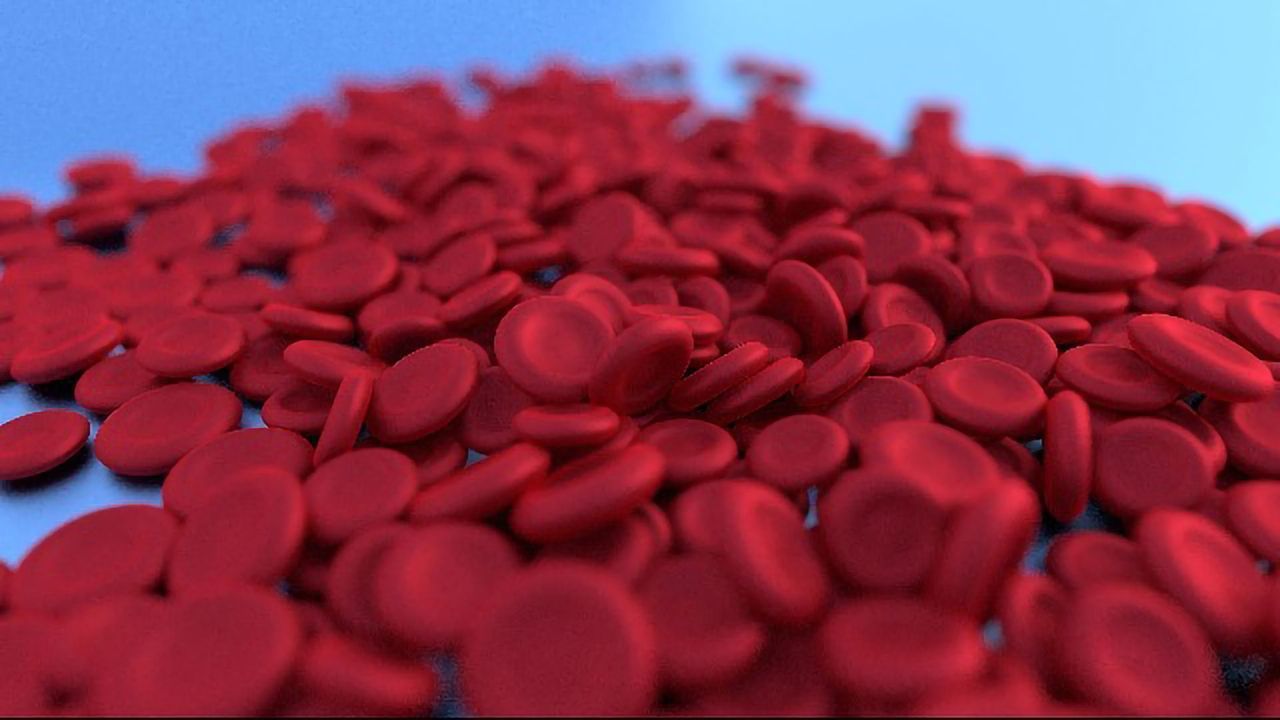 Diagnosing Vitamin B12 Deficiency Anemia