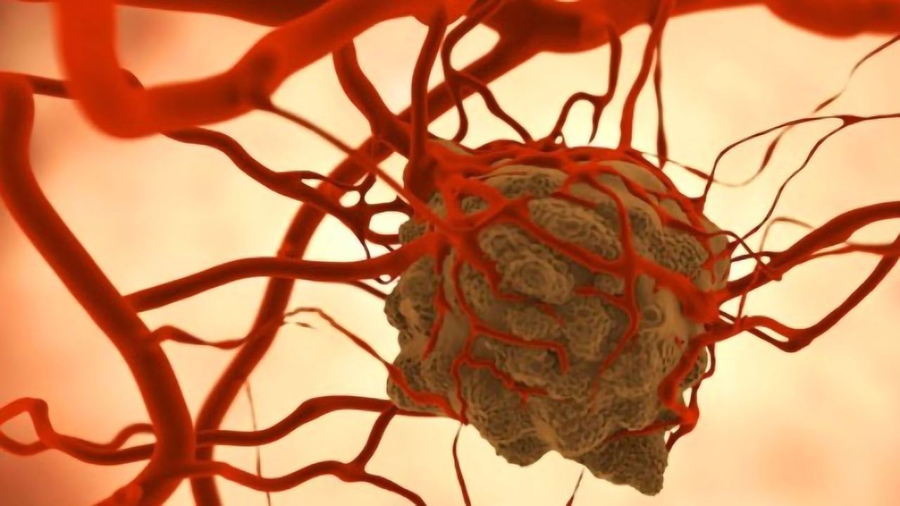 Team Inhibits Molecule in Myeloid Cells To Shrink Tumors