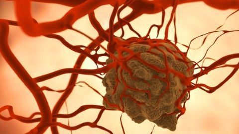 Team Inhibits Molecule in Myeloid Cells To Shrink Tumors