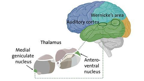 Schizophrenia: Is the Thalamus Misleading the Ear?