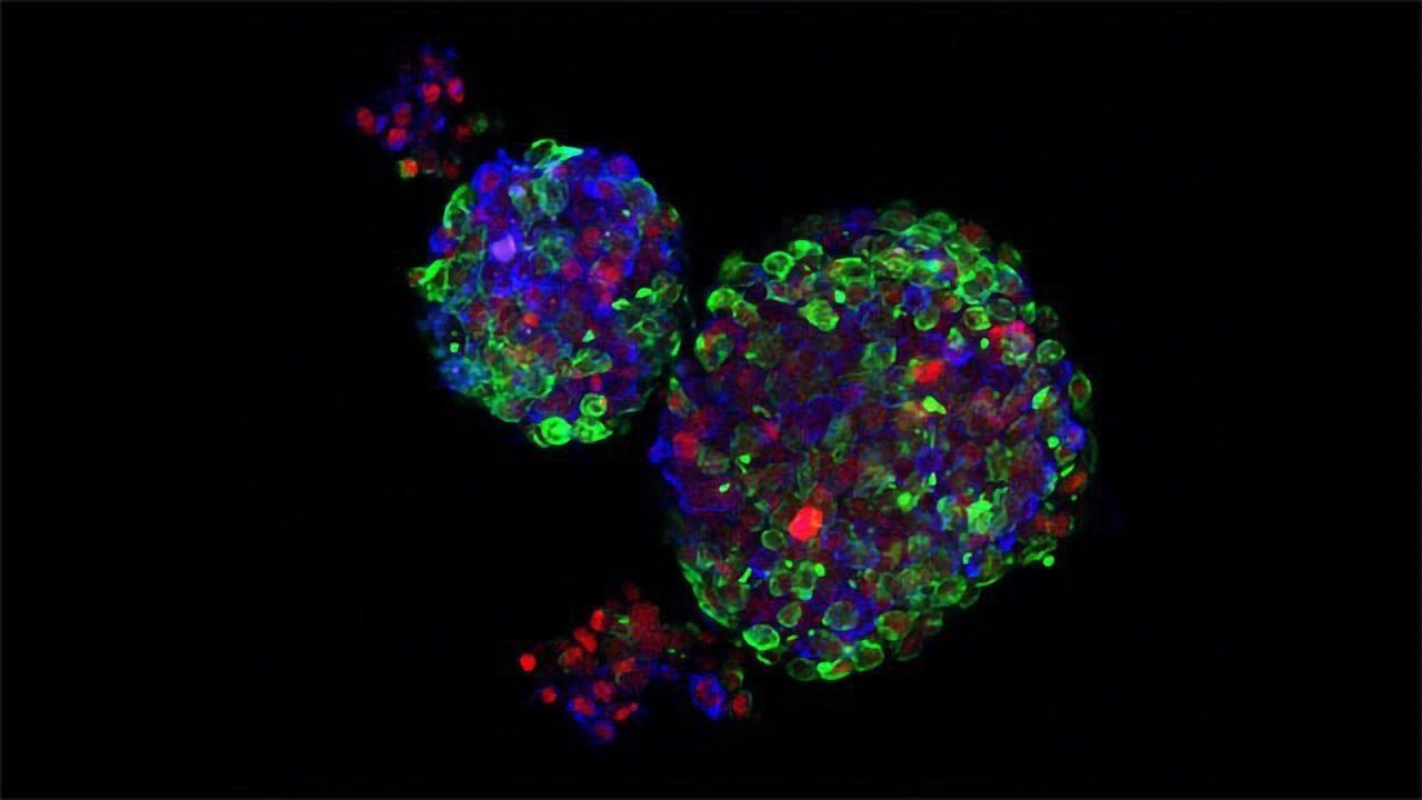 Human Breast Organoids