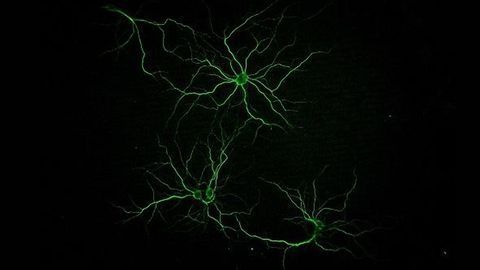 Marine Molecules With Therapeutic Potential Against Alzheimer's Disease