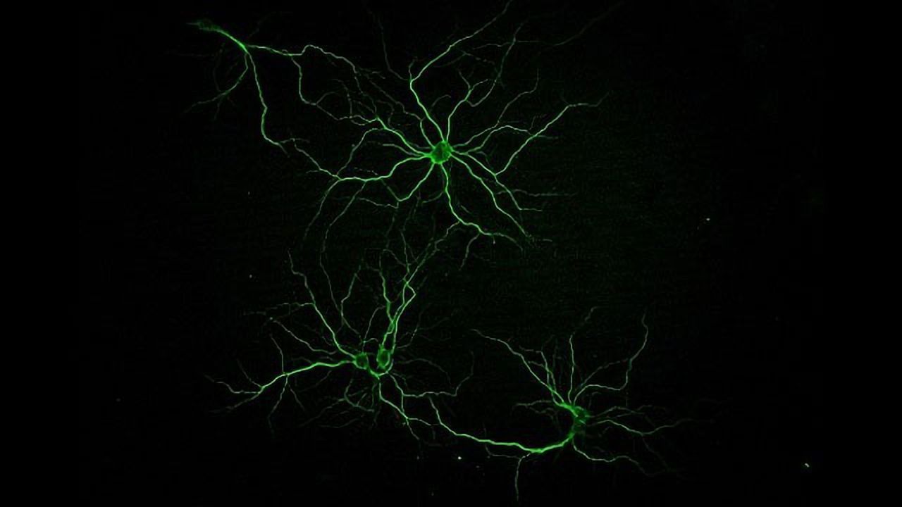 Primary Neurons in Culture