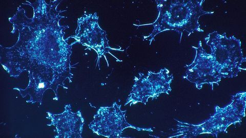 Cells Inside Cells: The Bacteria That Live in Cancer Cells