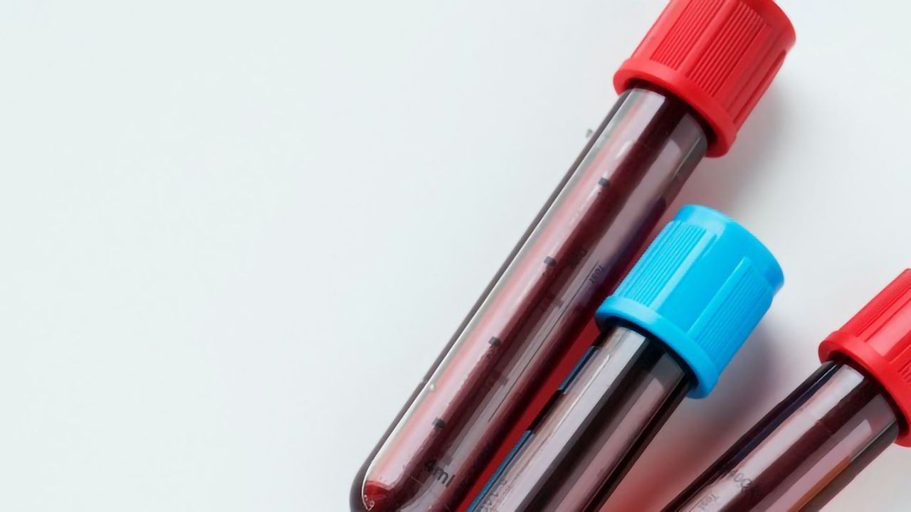 Analyzing Blood Metabolites in ALS Could Reveal or Rule Out Biomarkers for Disease