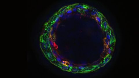 Ramping Up Drug, Vaccine and Infectivity Testing With Airway Organoids