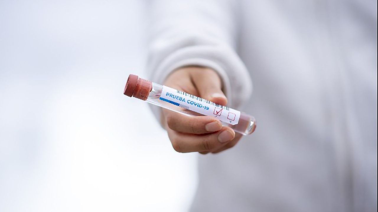 Experts Urge Caution in Interpreting COVID-19 Antibody Tests