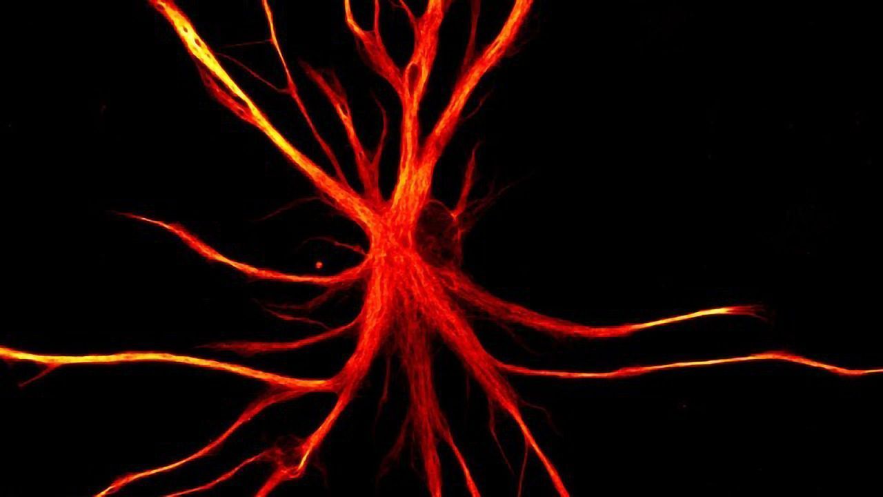 When Astrocytes Go Rogue: Why Do The Brain's Support Cells Turn Into Neuron Killers?