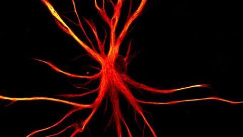 When Astrocytes Go Rogue: Why Do The Brain's Support Cells Turn Into Neuron Killers?