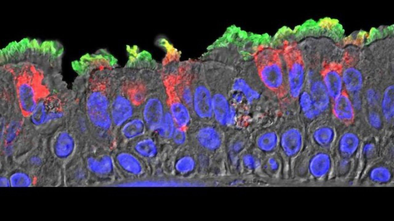 Researchers Map SARS-CoV-2 Infection in Cells of the Nasal Cavity, Bronchia and Lungs