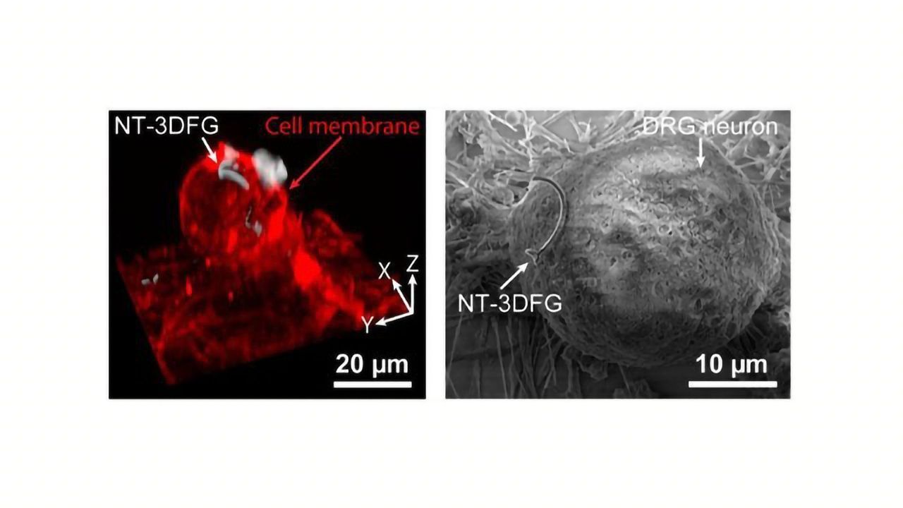 Light-based Technique Is a Remote Control for Neurons