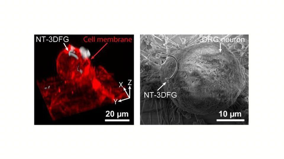 Light-based Technique Is a Remote Control for Neurons content piece image