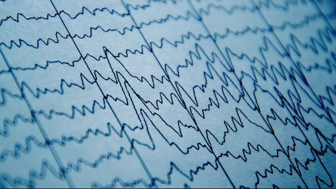 Out-of-Sync Brain Waves May Underlie Learning Deficit Linked to Schizophrenia