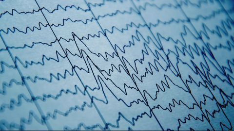 Out-of-Sync Brain Waves May Underlie Learning Deficit Linked to Schizophrenia