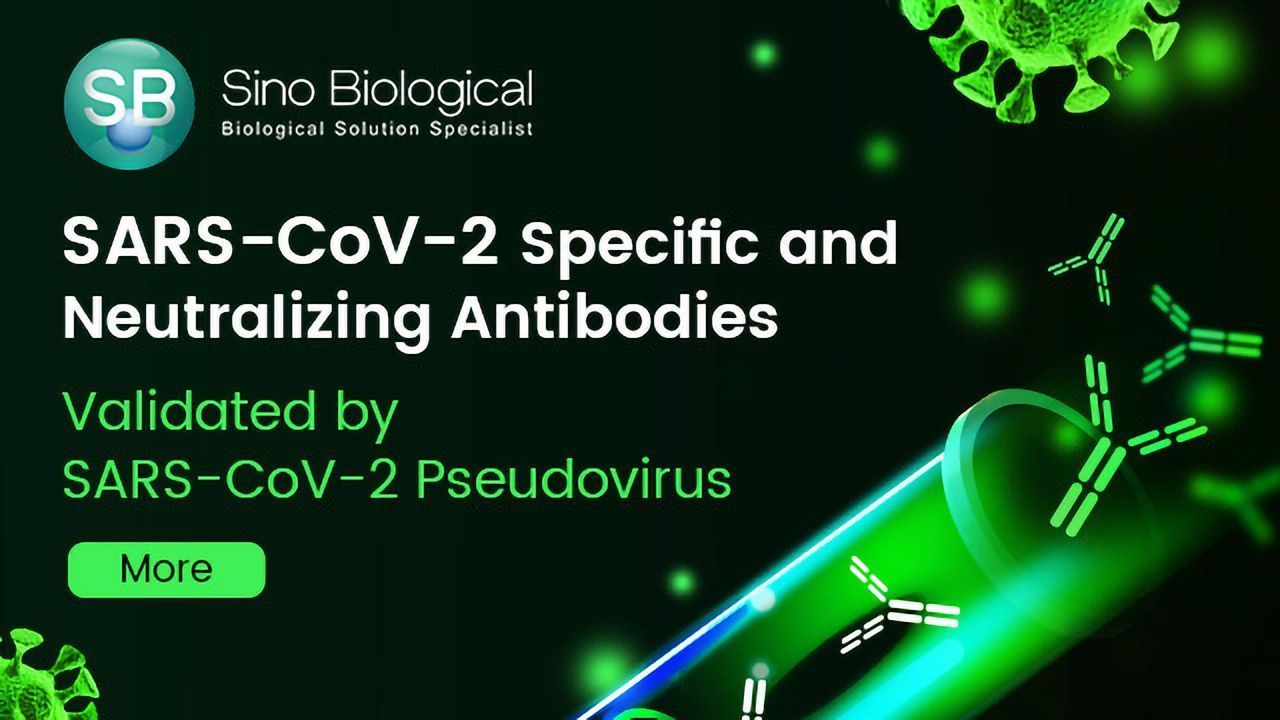 SARS-CoV-2 Specific and Neutralizing Antibodies