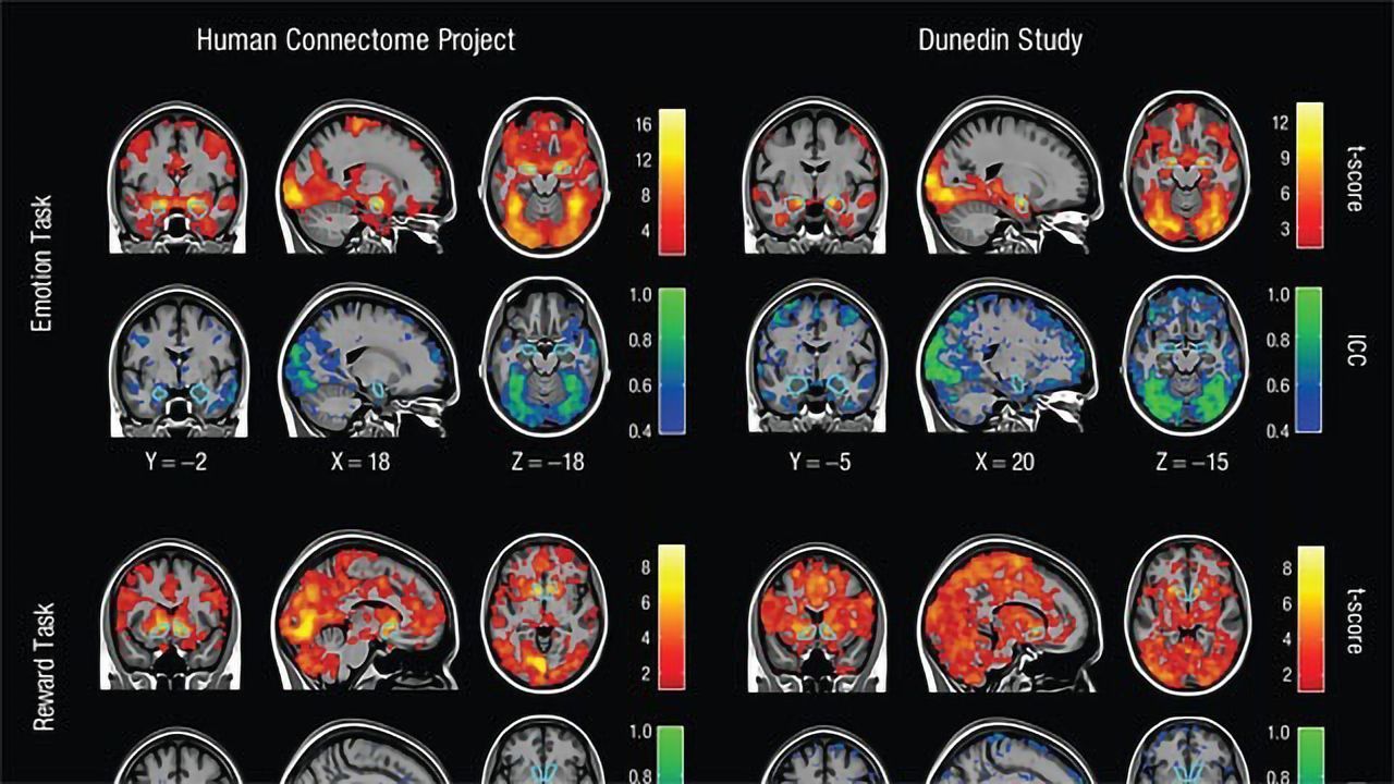 Brain Imaging Researcher Identifies Serious Flaw... in Brain Imaging