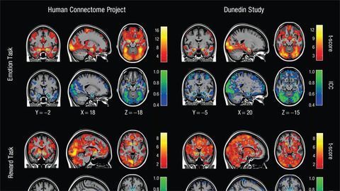 Brain Imaging Researcher Identifies Serious Flaw... in Brain Imaging