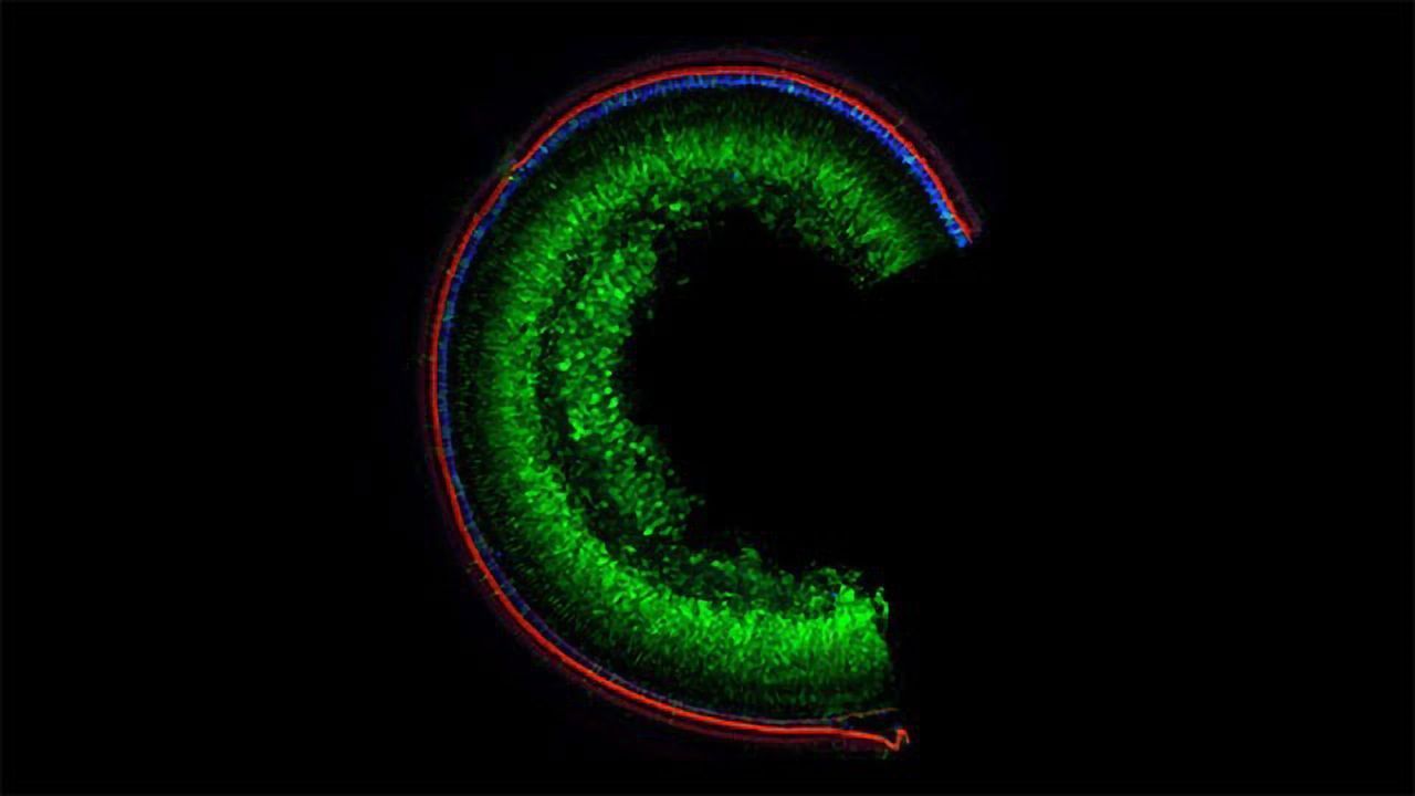 Gene Editing Technique Restores Hearing to Mice With Genetic Deafness