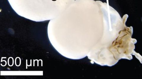 Hairy, Lab-grown Human Skin Cell Model Could Advance Hair Loss Research