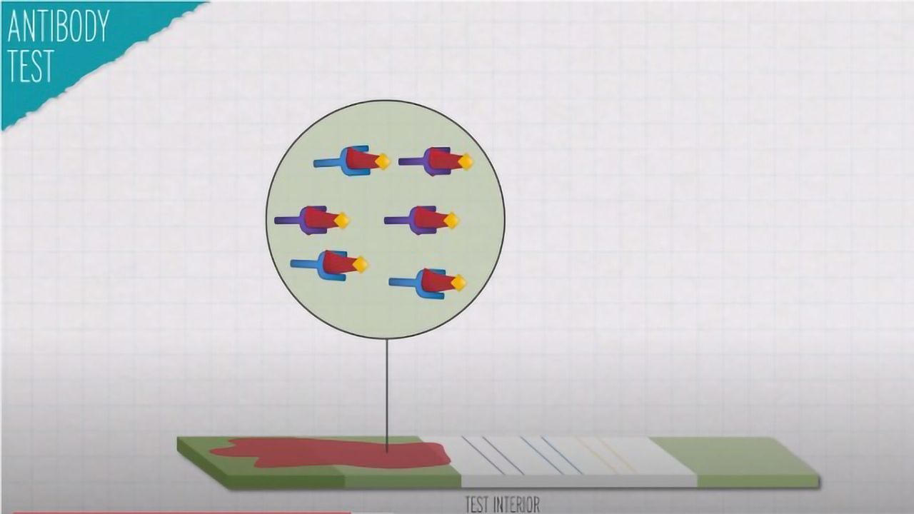 Why Are Antibody Tests Failing?