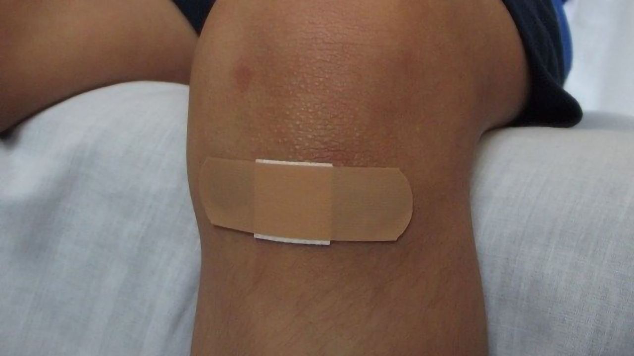 Deconstructing Tissue Repair