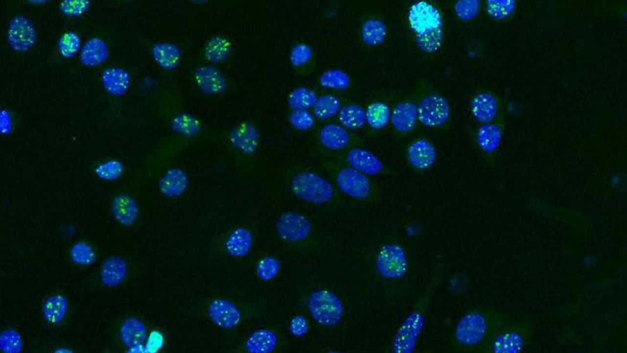 How Cancer Develops Resistance to Treatment