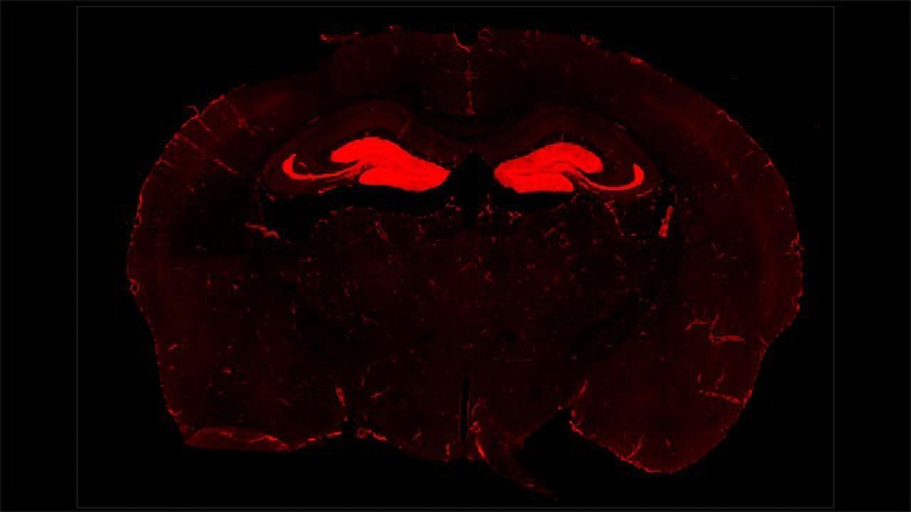 This Receptor Mediates the Effects of Chronic Stress in the Brain