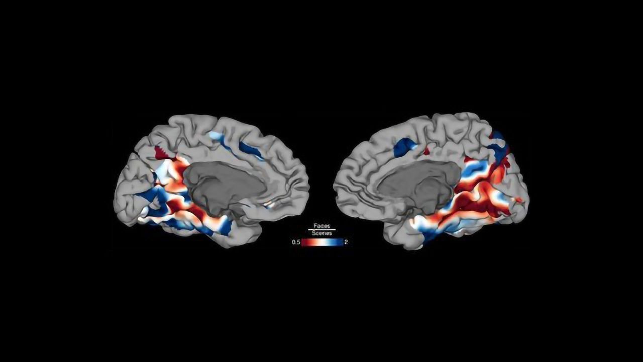 Identifying the Brain Regions Linked to Facial Recognition