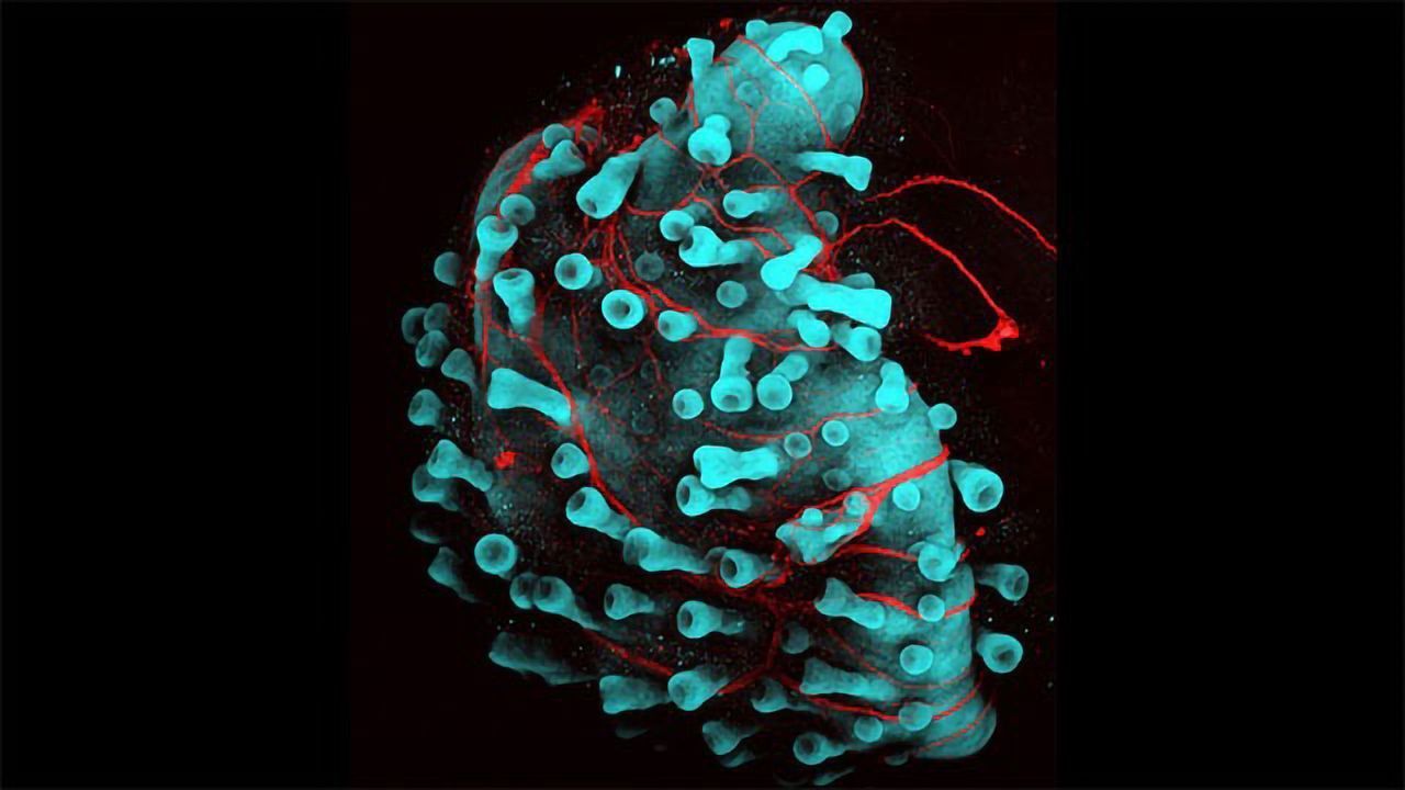 Growing Hair Follicles in Cultured Human Skin Cells