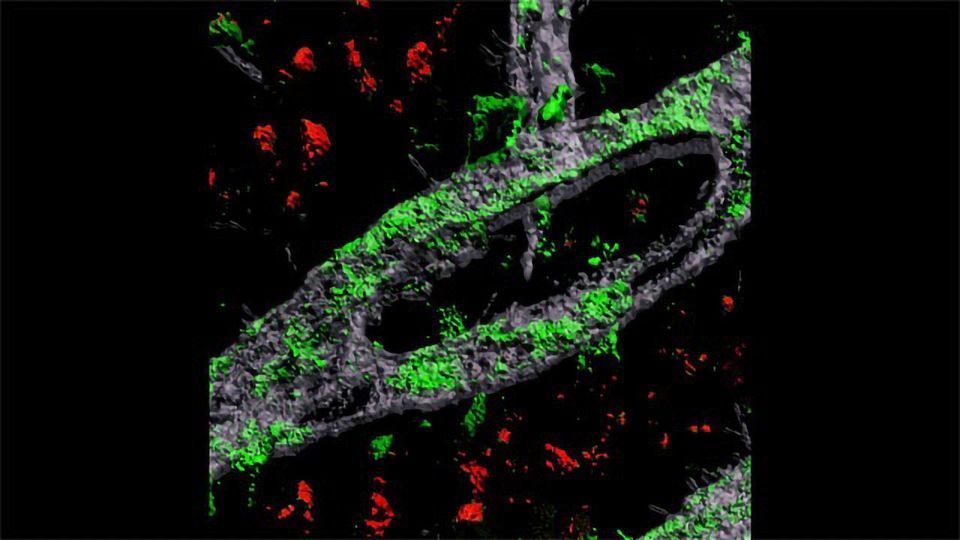 Blood-Brain Barrier-in-a-Dish Leads to Alzheimer's Discovery content piece image