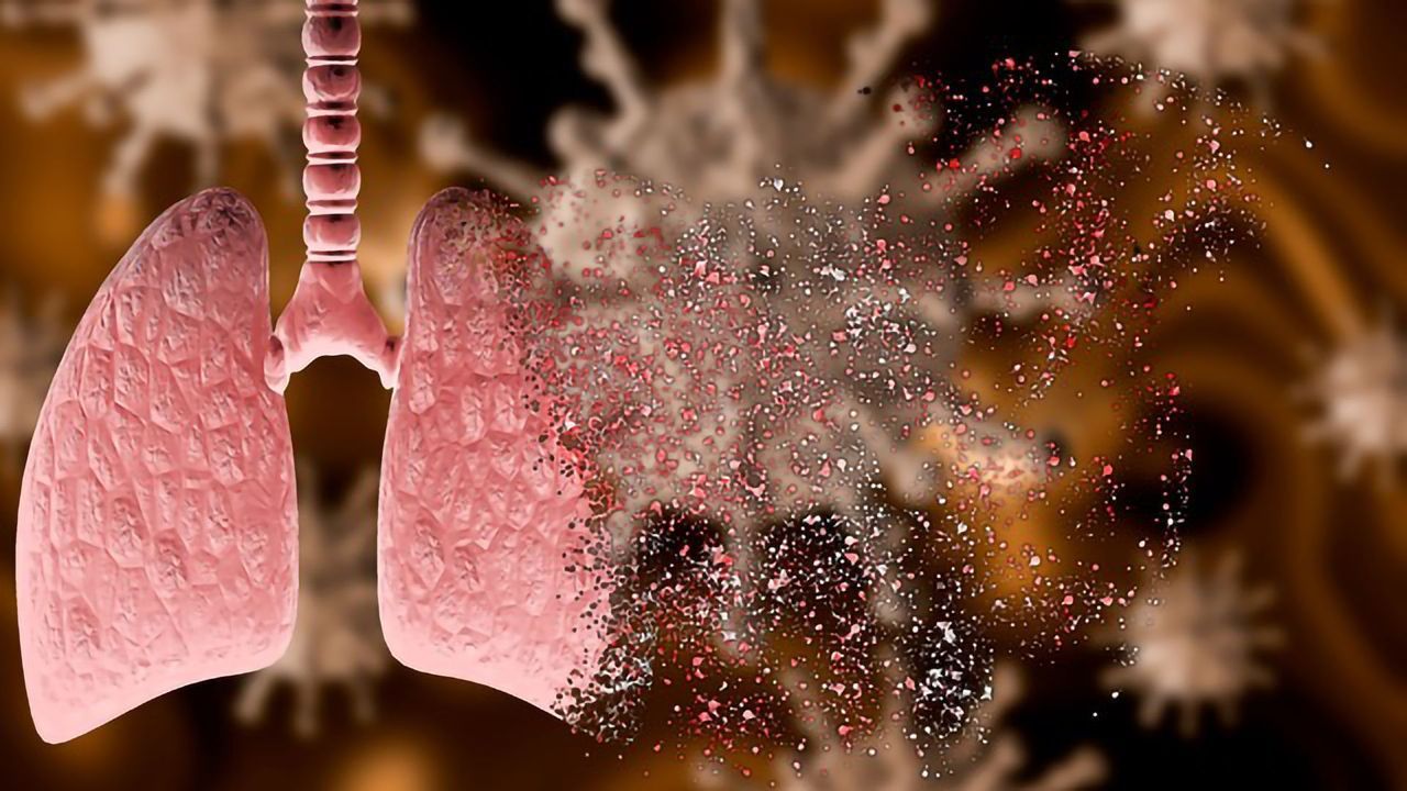 Rebalancing RAS To Treat COVID-19-induced Lung Inflammation