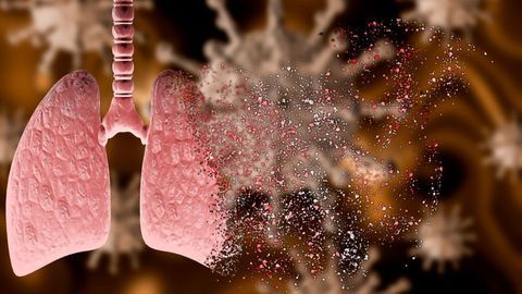 Rebalancing RAS To Treat COVID-19-induced Lung Inflammation