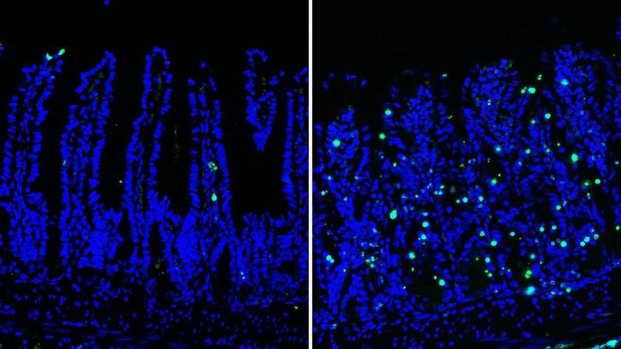 Enzyme Essential for Intestinal Stem Cell Survival Identified