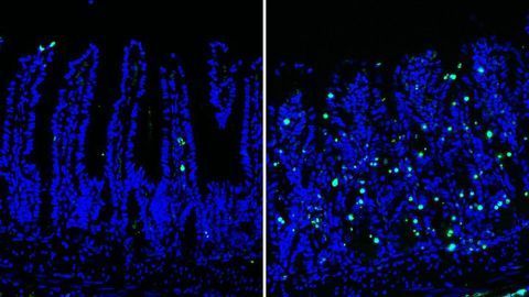 Enzyme Essential for Intestinal Stem Cell Survival Identified