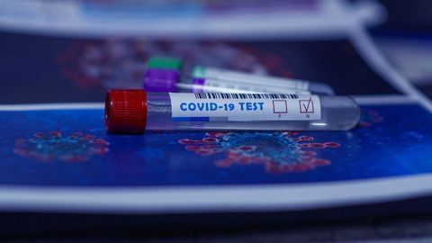 Study Highlights Importance of Periodically Re-evaluating COVID-19 Tests