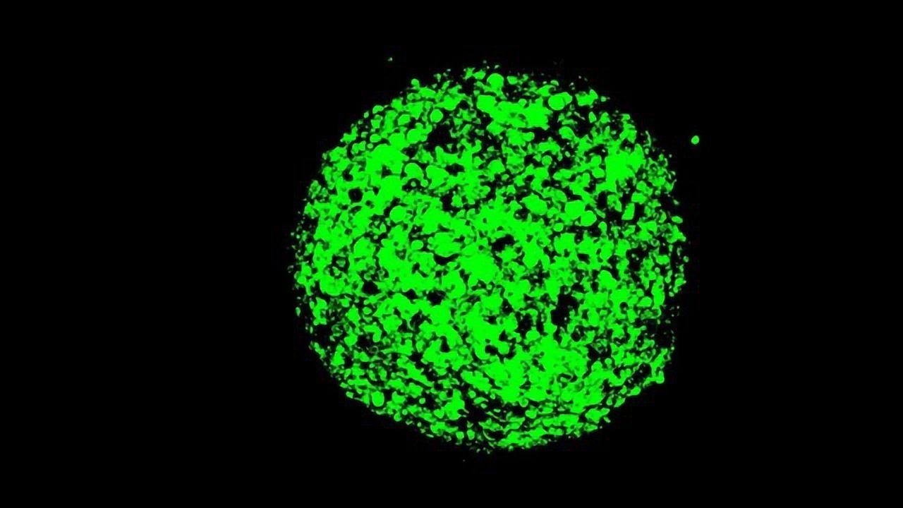 Chemo Plus Immunotherapy Shows Promise As First-line Treatment for Mesothelioma